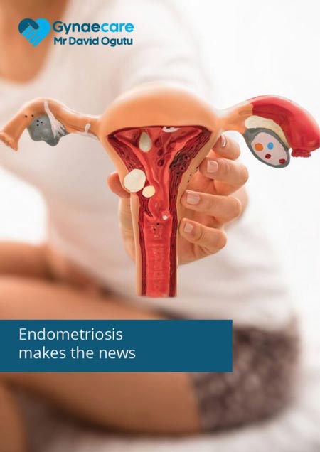 Endometriosis makes the news
